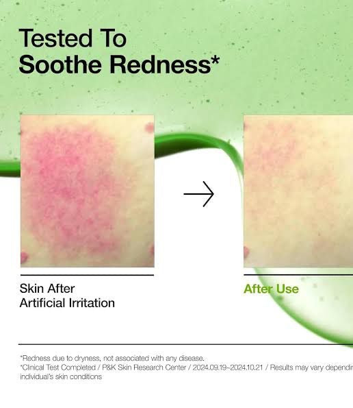 Anua Azeleic Acid Skin Clarifying Toner